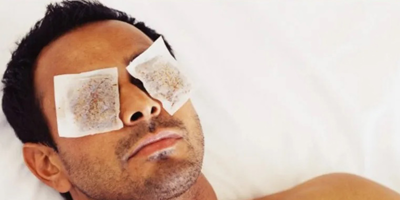 درمان خانگی برق گرفتگی چشم در جوشکاری با دستگاه جوش